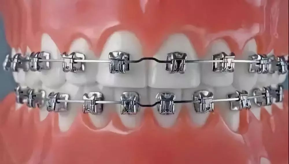 畸形牙齿及具体改善方法，导致牙齿畸形的原因有哪些