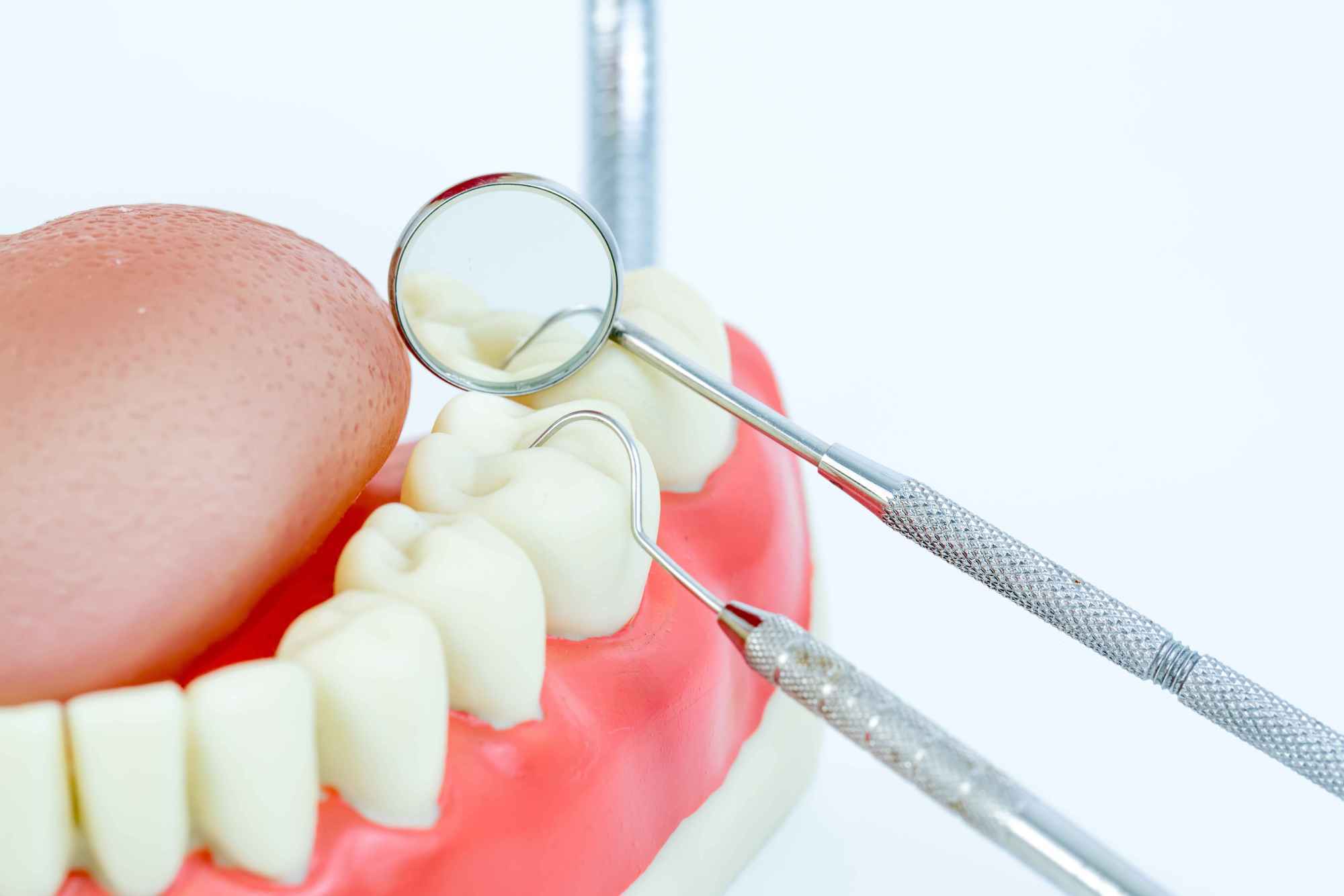 牙齿酸痛是为什么 什么原因会导致牙齿发酸牙痛是什么原因造成的
